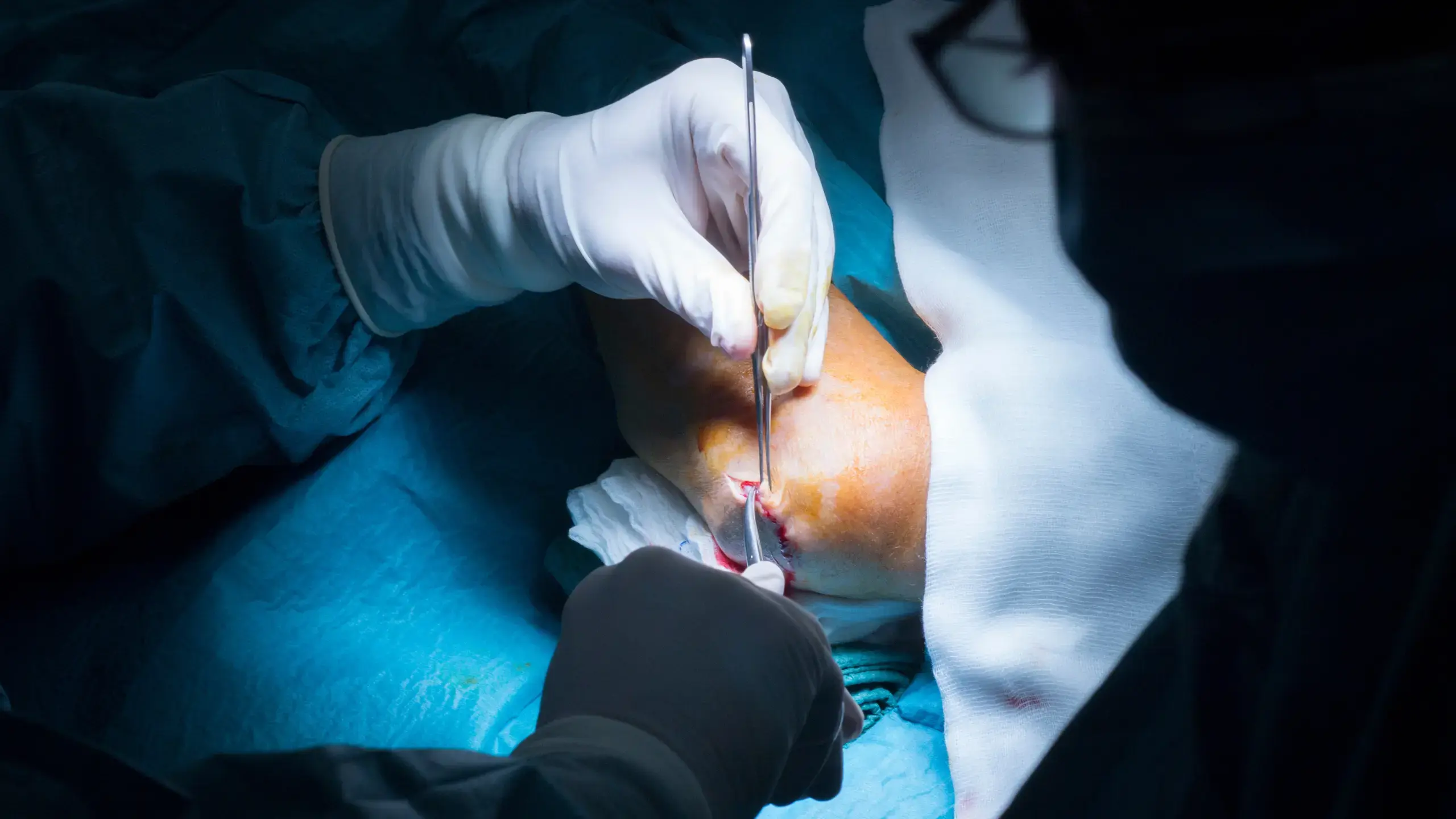 Complex Trauma Surgery By Dr. Manoj Kumar Gudluru