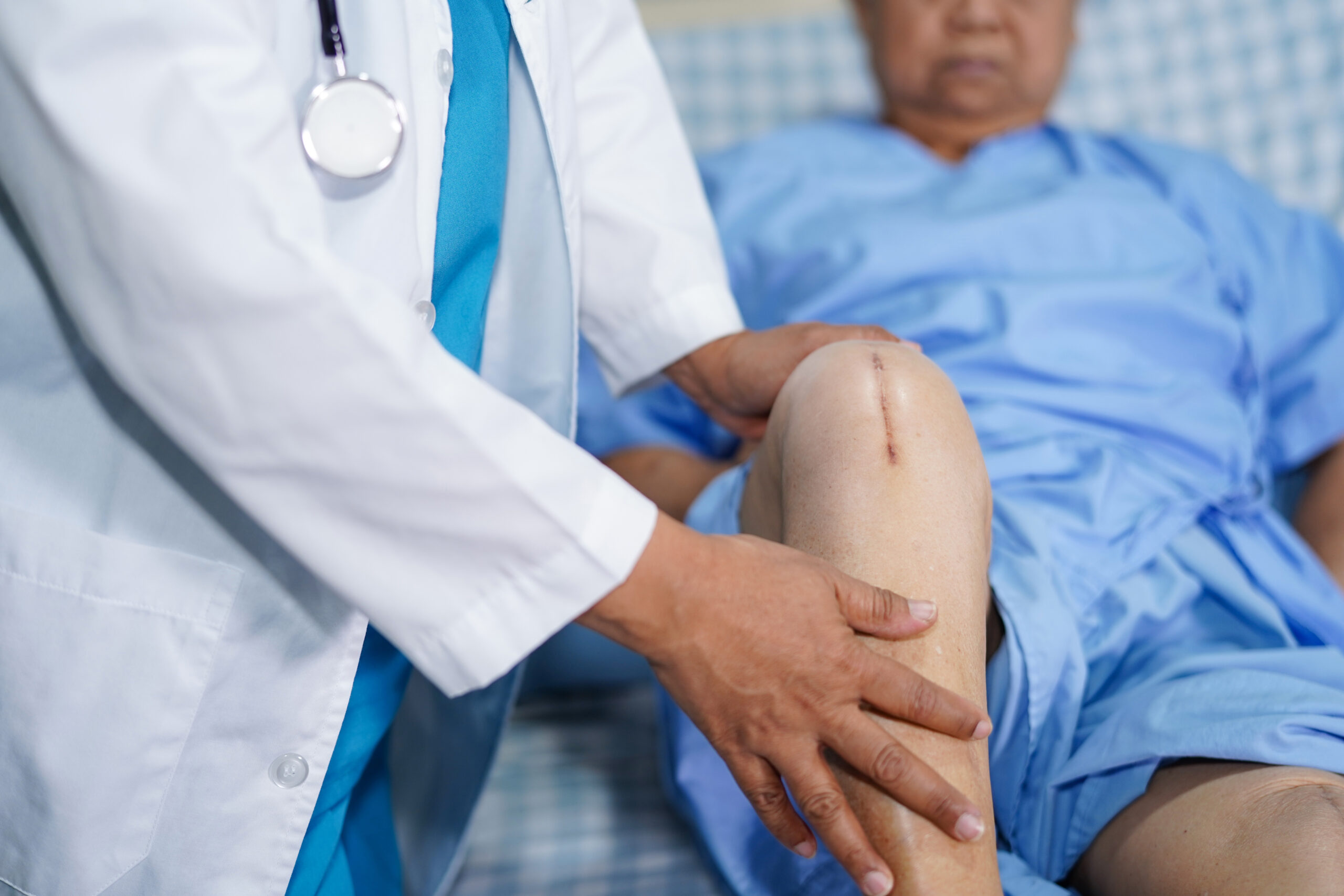 Knee Replacement surgery by Dr. Manoj Kumar Gudluru